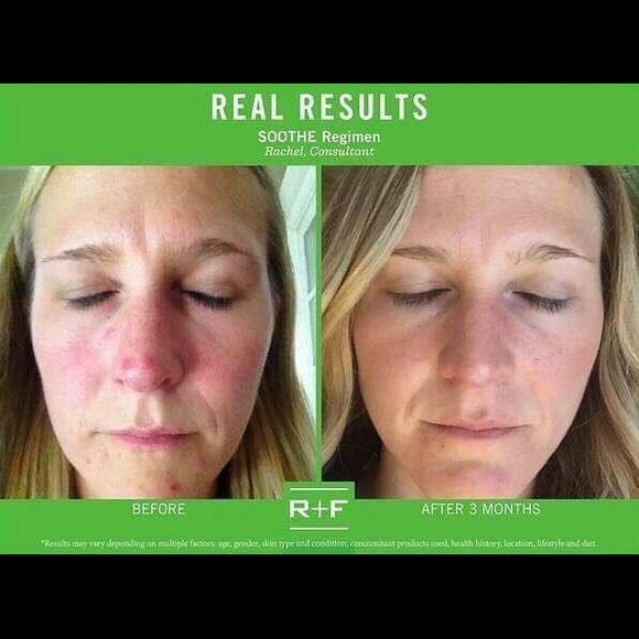 Rodan +Fields Deals and Sales - Picture 7 of 8